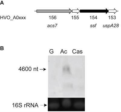 Acetate Metabolism in Archaea: Characterization of an Acetate Transporter and of Enzymes Involved in Acetate Activation and Gluconeogenesis in Haloferax volcanii